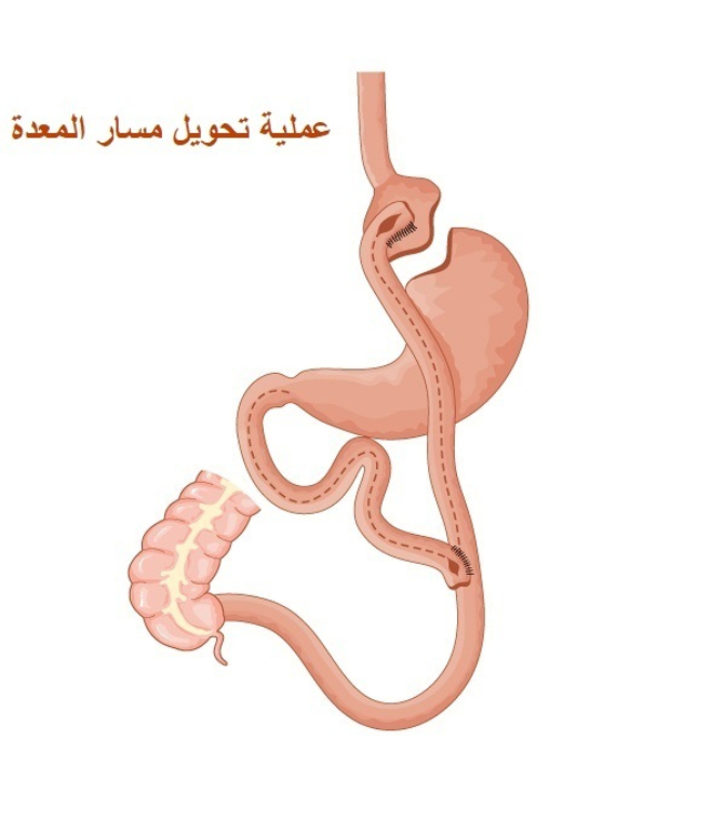 كيف تتم عملية تحويل المسار