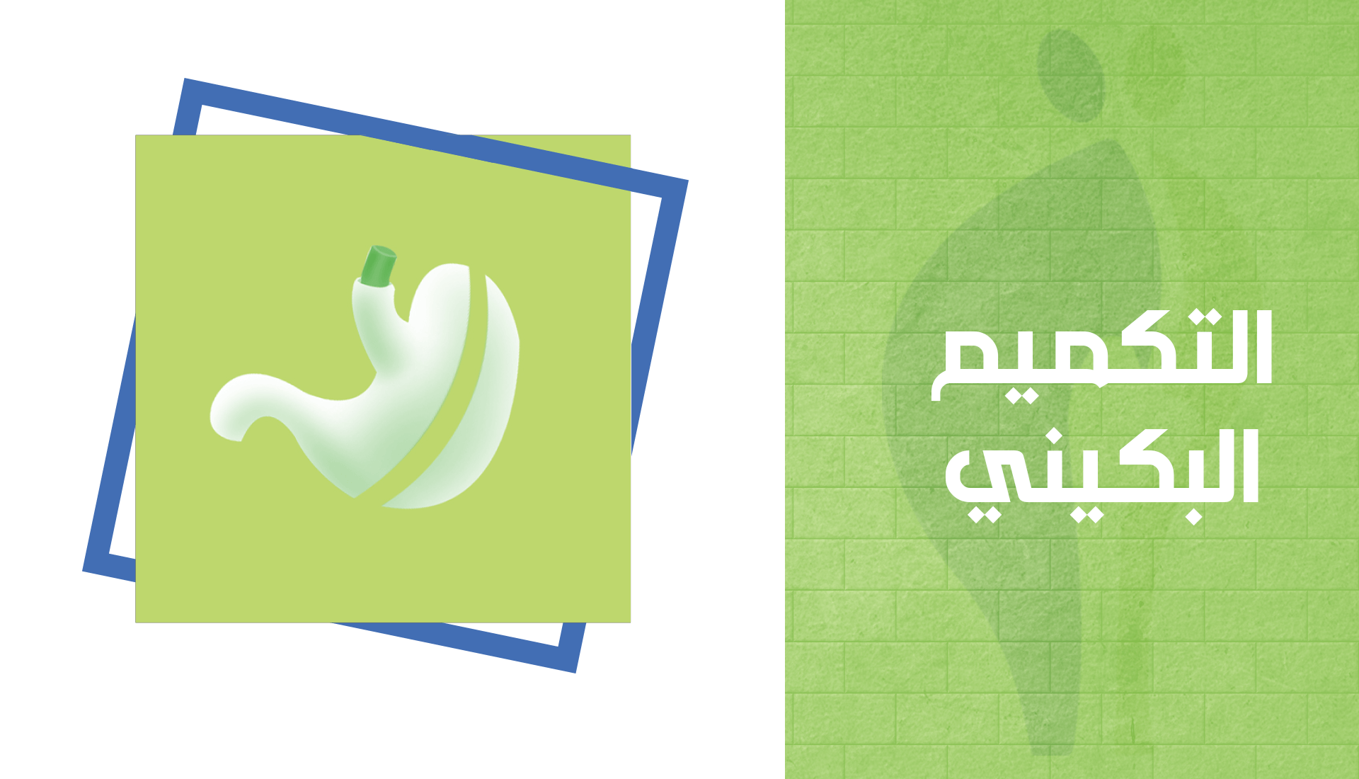 بعد التكميم البكيني