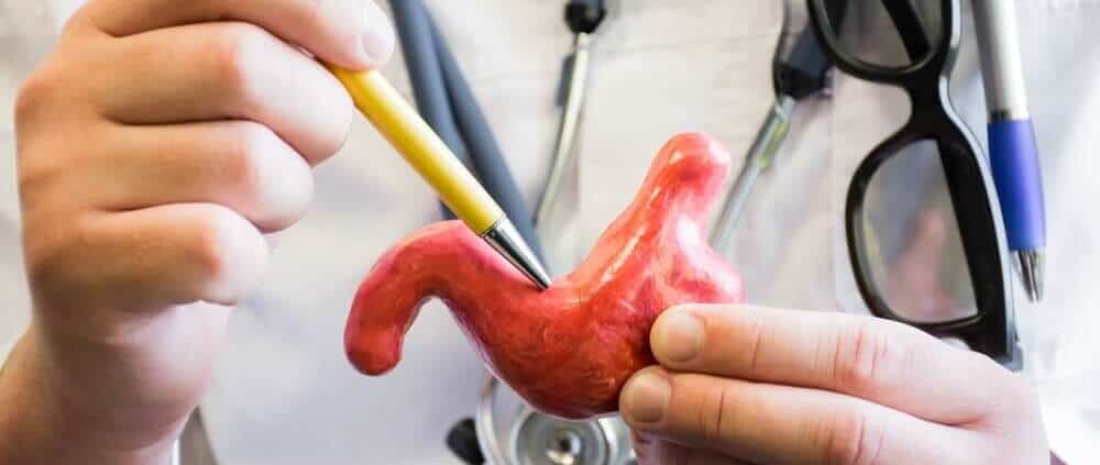 عملية التكميم بالمنظار